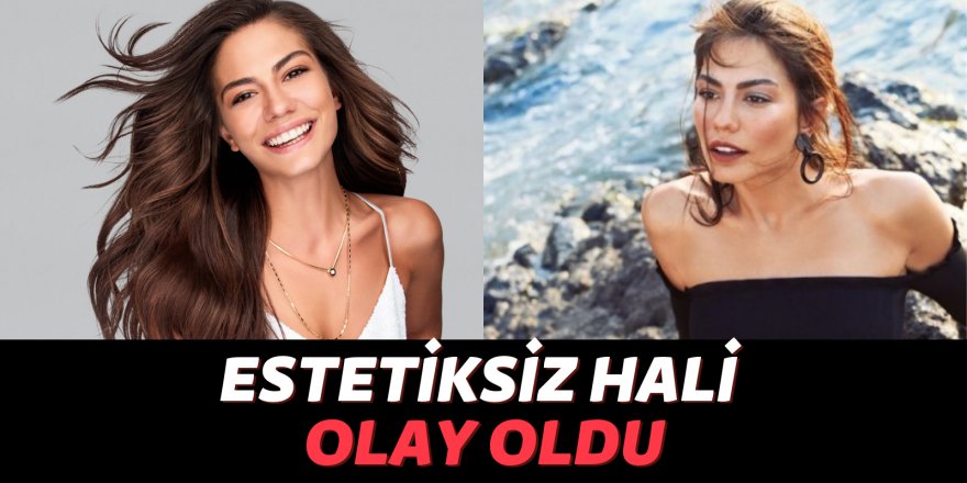 Demet Özdemir’in eski halini görenler şok oldu!