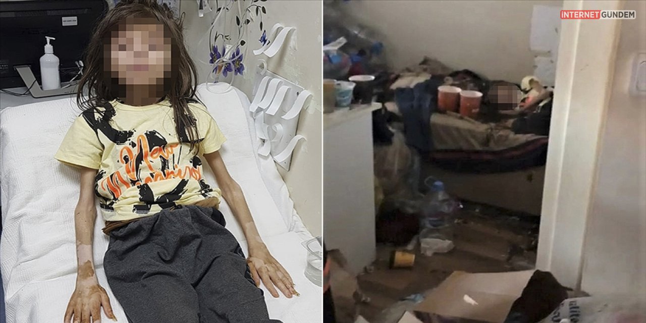 1 Sene Boyunca Çöp Evde Yaşayan Çocuğun Sağlığı Ne Durumda? Açıklama Yapıldı..