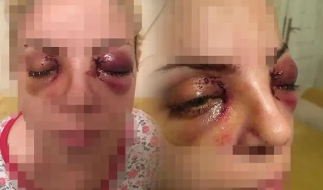 Adana, Mersin ve İzmir'de vahşet! Önüne gelenin gözünü oyuyor...