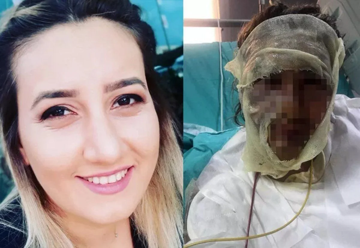 Aşk mı, Hastalık mı? Öldürülüyordu Affedilmesini İstedi!