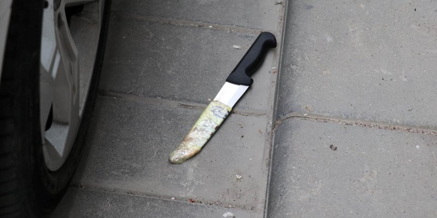 Denizli’de Yaşanan Kıskançlık Krizi Bu Kadar da Olmaz Dedirtti!